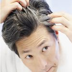 Hair Loss Treatment