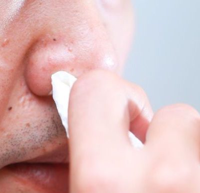 Nose treatment