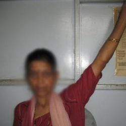 During Treatment Progress 1