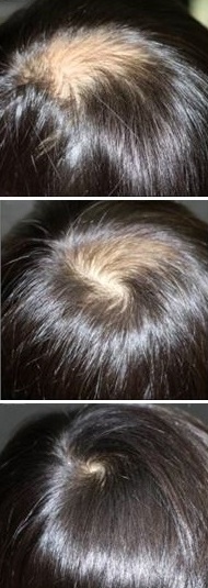 Scalp close up 1