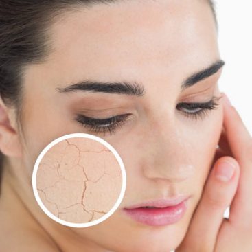 Dry skin