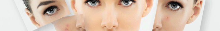 Guaranteed Homeopathic Treatments For All Types Of Skin Banner