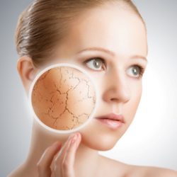 Dry Skin Overlay Chart
